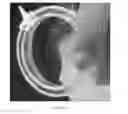 Fig. 27 - Surgical tissue stabilizers and related methods