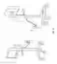 Fig. 31 - Surgical tissue stabilizers and related methods