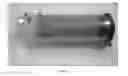 Fig. 33 - Surgical tissue stabilizers and related methods