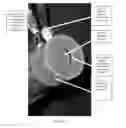 Fig. 57 - Surgical tissue stabilizers and related methods