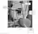 Fig. 58 - Surgical tissue stabilizers and related methods