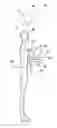 Fig. 01 - X-ray scatter reducing device for use with 2D mammography and tomosynthesis
