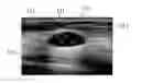 Fig. 01 - Apparatus and method for aiding imaging diagnosis