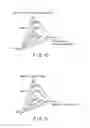 Fig. 08 - Medical image processing apparatus and medical image processing method