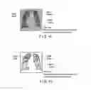Fig. 09 - Medical image processing apparatus and medical image processing method