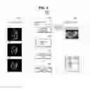 Fig. 04 - ULTRASOUND IMAGING APPARATUS AND CONTROLLING METHOD THEREOF