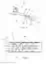 Fig. 03 - ENDOSCOPIC CLOSURE DEVICE USING SEALANTS