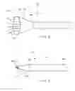 Fig. 05 - ENDOSCOPIC CLOSURE DEVICE USING SEALANTS