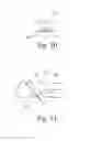 Fig. 07 - Instruments for use in femoroacetabular impingement procedures