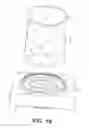 Fig. 11 - Wound retractor device