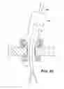 Fig. 49 - Wound retractor device