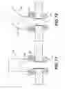 Fig. 53 - Wound retractor device