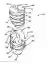Fig. 01 - Knotless suture anchor and method of using same