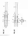 Fig. 04 - Medical Suture Needle