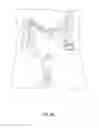 Fig. 28 - Magnetic anastomosis devices and methods of delivery