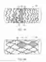 Fig. 04 - Covered embolic coils