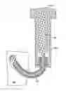 Fig. 01 - Selective spinal tissue removal apparatus and method