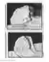 Fig. 08 - Selective spinal tissue removal apparatus and method