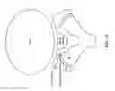 Fig. 15 - Selective spinal tissue removal apparatus and method