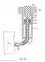 Fig. 23 - Selective spinal tissue removal apparatus and method