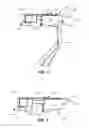 Fig. 02 - Surgical access tools, guide instruments and accessories for subchondral treatment of bone