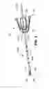 Fig. 03 - Surgical access tools, guide instruments and accessories for subchondral treatment of bone