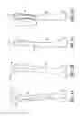 Fig. 02 - Devices and methods for trochanteric osteotomy