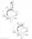 Fig. 03 - Spinal marker system and methods of use