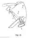 Fig. 08 - Systems, devices, and methods for guiding surgical devices into bone
