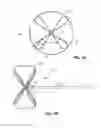 Fig. 02 - RETRIEVAL AND CENTERING DEVICE AND METHOD WITH PRESSURE AND ULTRASOUND FEATURES