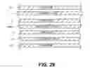 Fig. 27 - RETRIEVAL AND CENTERING DEVICE AND METHOD WITH PRESSURE AND ULTRASOUND FEATURES