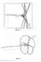 Fig. 10 - RETRIEVAL AND CENTERING DEVICE AND METHOD WITH PRESSURE AND ULTRASOUND FEATURES