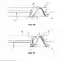 Fig. 15 - RETRIEVAL AND CENTERING DEVICE AND METHOD WITH PRESSURE AND ULTRASOUND FEATURES