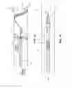 Fig. 16 - RETRIEVAL AND CENTERING DEVICE AND METHOD WITH PRESSURE AND ULTRASOUND FEATURES