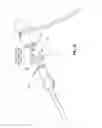 Fig. 17 - RETRIEVAL AND CENTERING DEVICE AND METHOD WITH PRESSURE AND ULTRASOUND FEATURES