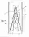 Fig. 30 - RETRIEVAL AND CENTERING DEVICE AND METHOD WITH PRESSURE AND ULTRASOUND FEATURES