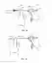 Fig. 05 - MEDICAL DEVICE AND METHOD