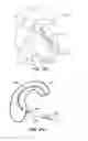 Fig. 10 - MEDICAL DEVICE AND METHOD