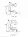 Fig. 11 - MEDICAL DEVICE AND METHOD
