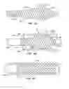 Fig. 15 - MEDICAL DEVICE AND METHOD