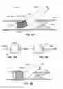 Fig. 24 - MEDICAL DEVICE AND METHOD