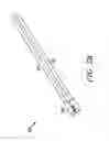 Fig. 06 - Unfocused electrohydraulic lithotripter