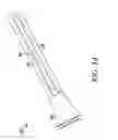 Fig. 07 - Unfocused electrohydraulic lithotripter