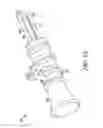 Fig. 11 - Unfocused electrohydraulic lithotripter