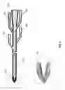 Fig. 06 - METHOD AND APPARATUS FOR LITHIASIS TREATMENT