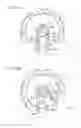 Fig. 16 - Medical manipulator