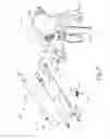 Fig. 04 - Ultrasonic blade overmold