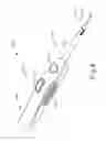 Fig. 09 - Ultrasonic blade overmold