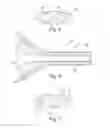 Fig. 04 - TROCAR