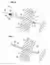 Fig. 04 - Modified veress needle for tension pneumothorax decompression